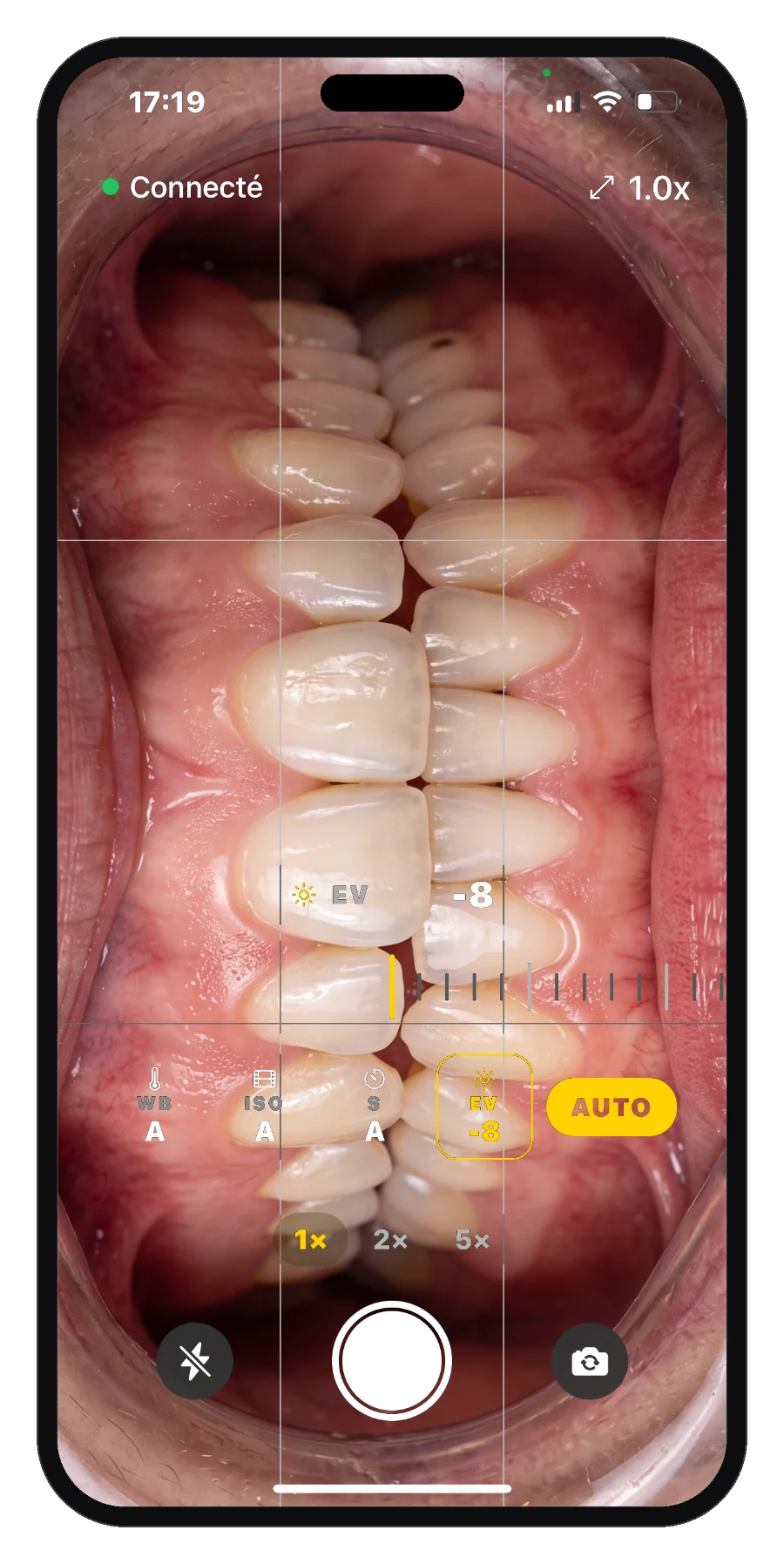 iPhone connecté au logiciel U-SHOOT, vue endobuccale à l'écran avec grille de composition et réglages manuels