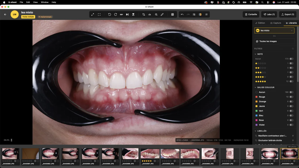 L'interface d'U-SHOOT affichant une photographie intra-orale et la bibliothèque de photos du patient