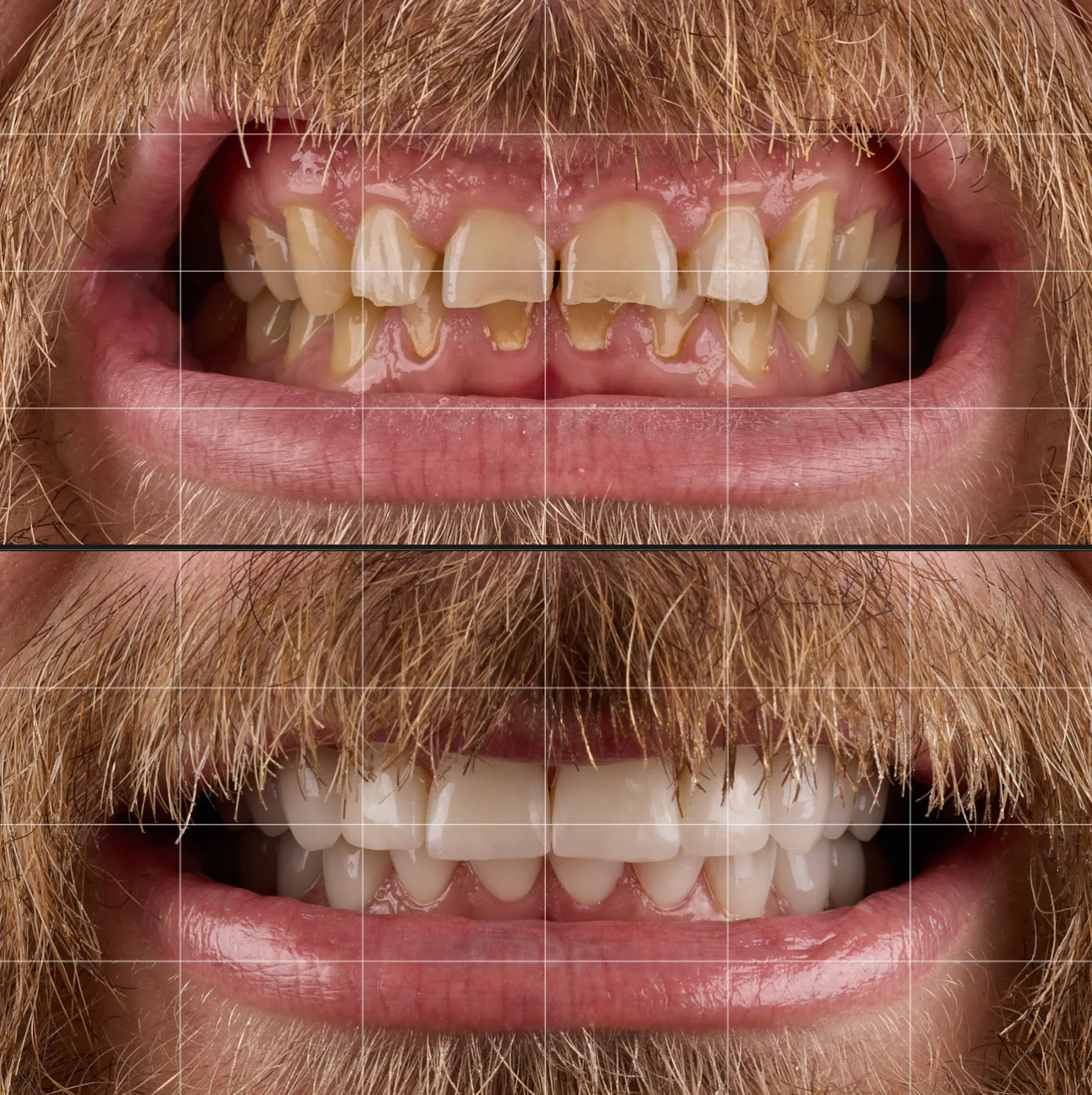 Reproductibilité — sourire avant / après avec grille de composition