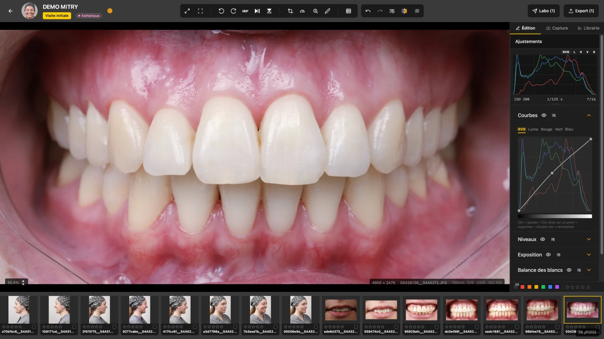 USHOOT — édition d'un cliché intra-oral avec histogramme et courbes RVB